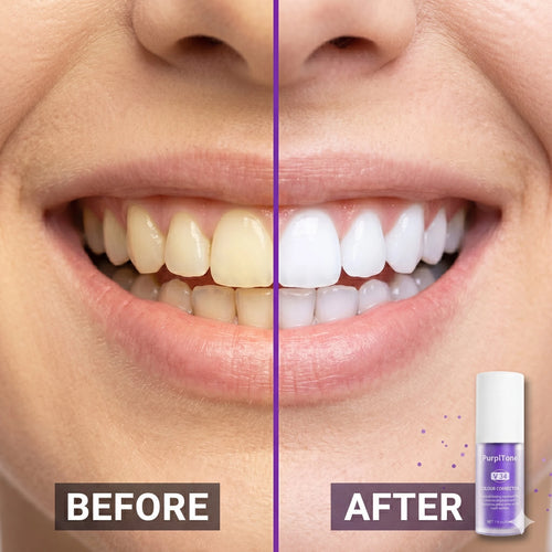 PurplTone™ Purple Colour Correcting Toothpaste
