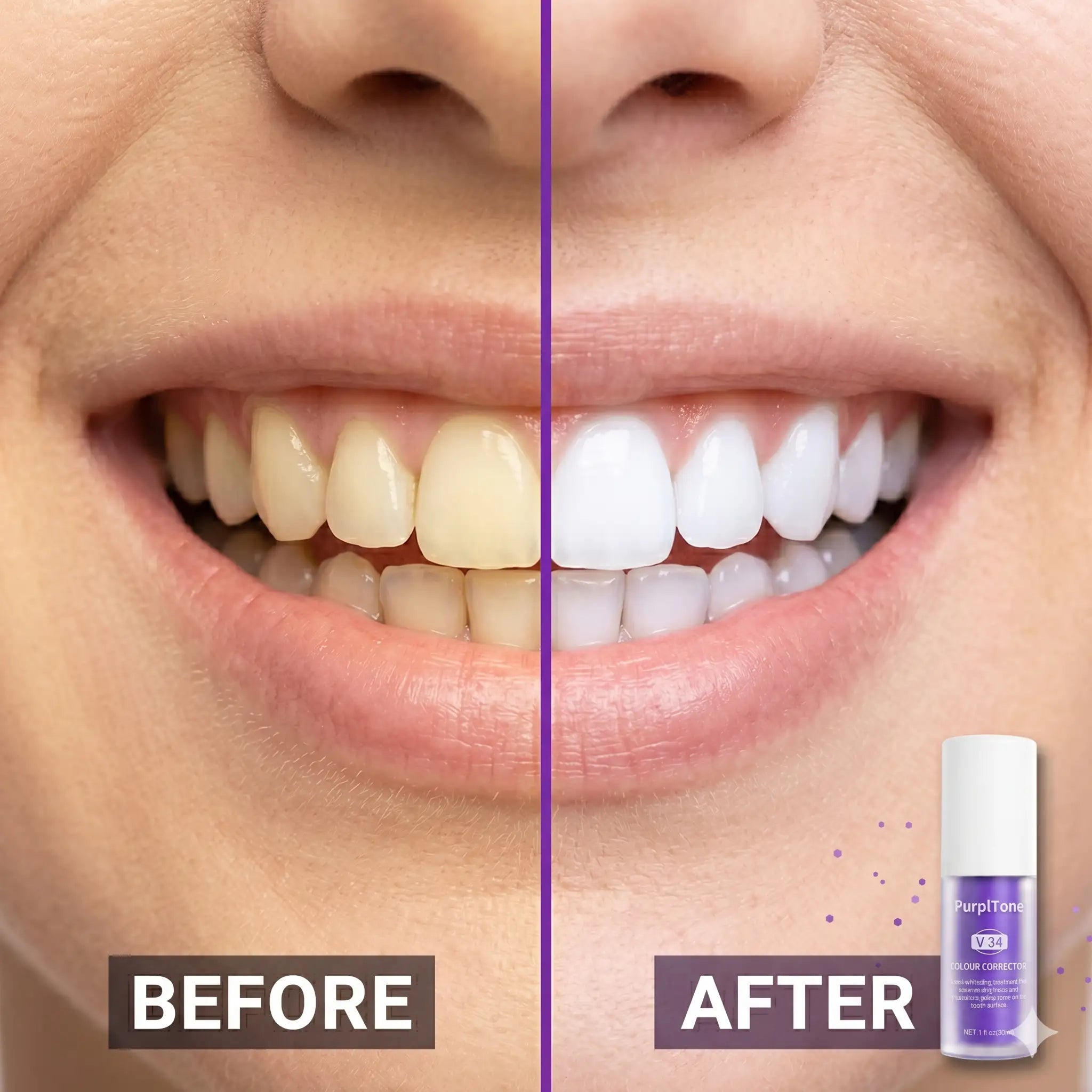 PurplTone™ Purple Colour Correcting Toothpaste